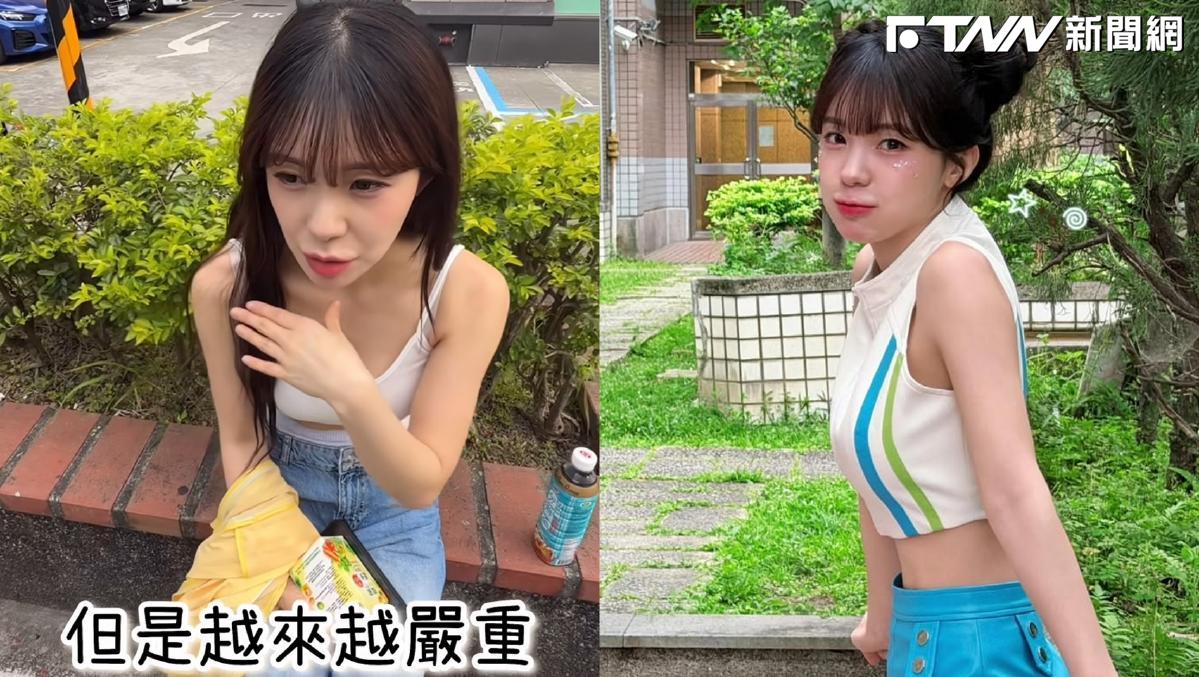 李多慧肩膀出狀況！痛到影響練舞直喊「壞掉了」　醫診斷韌帶發炎急打針